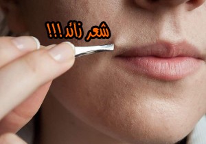 الشعر الزائد