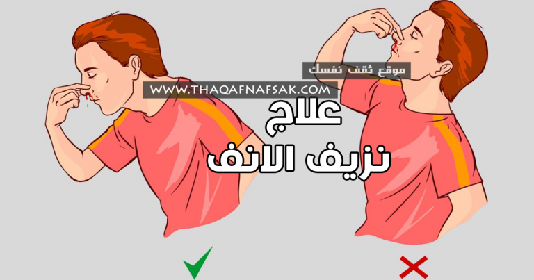 علاج نزيف الأنف