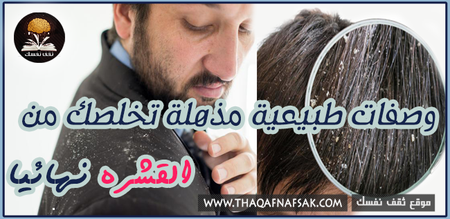 علاج قشرة الشعر