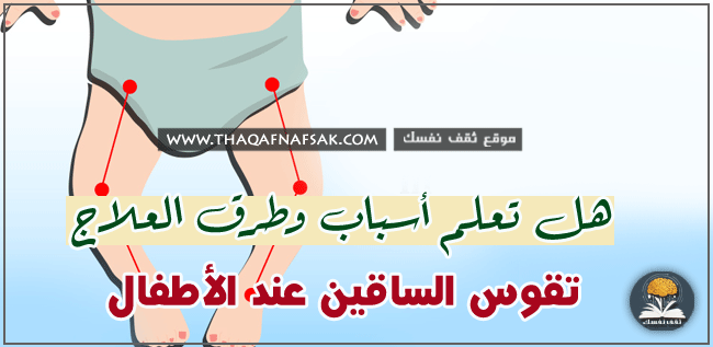 تقوس الساقين عند الأطفال