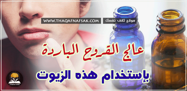 علاج قرحة البرد