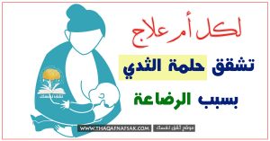 علاج تشقق الحلمة