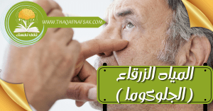 المياه الزرقاء ( الجلوكوما )