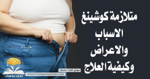 متلازمة كوشينغ