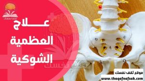 وصفات علاج العظمة الشوكية