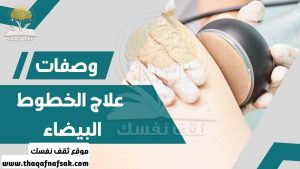 وصفات علاج الخطوط البيضاء