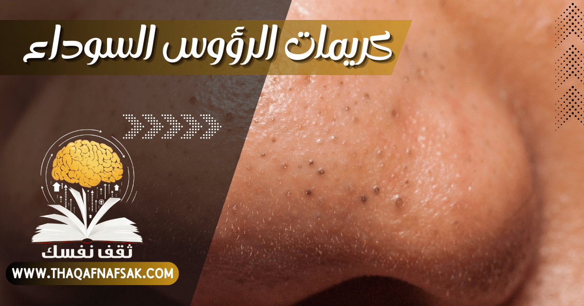 كريمات الرؤوس السوداء