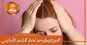 الميكروبليدنج لخط الشعر الأمامي