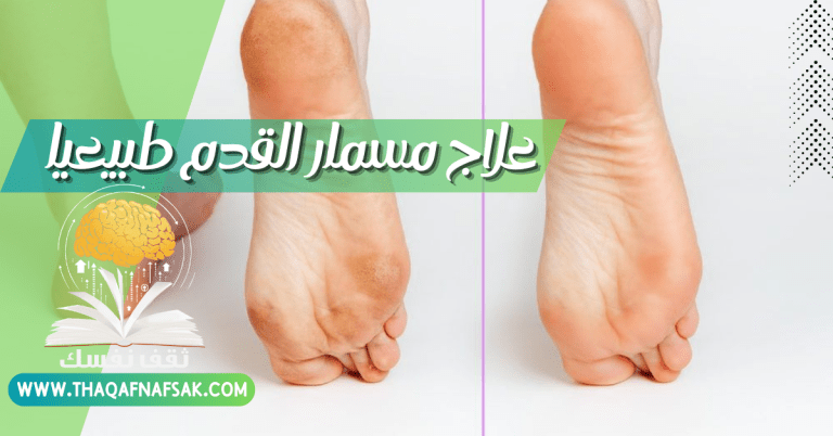 علاج مسمار القدم طبيعيا