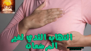 التهاب الثدي لغير المرضعات