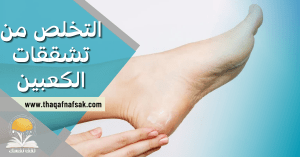 التخلص من تشققات الكعبين