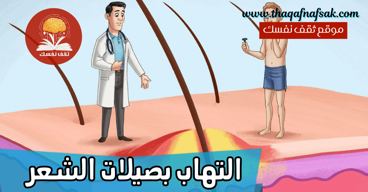 التهاب بصيلات الشعر