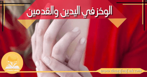 الوخز في اليدين والقدمين