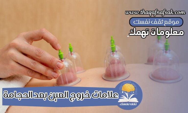 علامات خروج العين بعد الحجامة