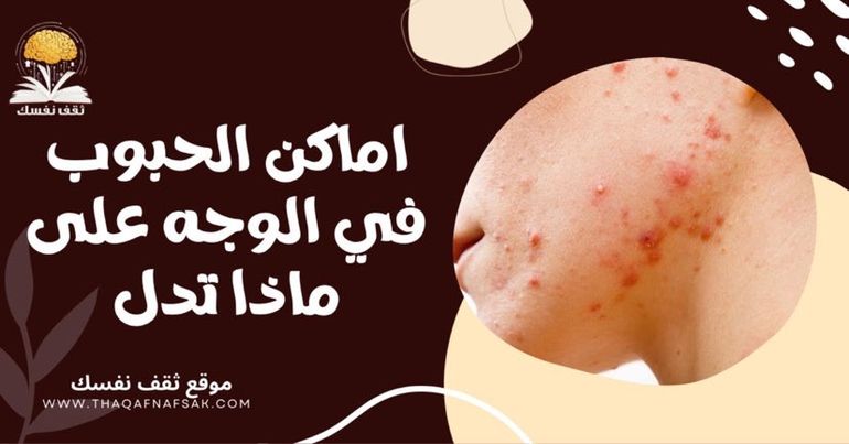 أماكن الحبوب في الوجه على ماذا تدل؟